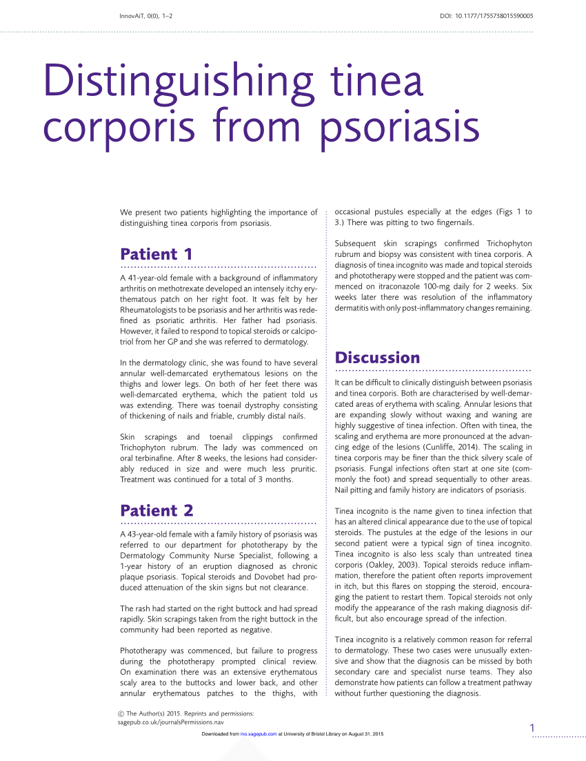 PDF] Tinea manuum misdiagnosed as psoriasis vulgaris: A case of