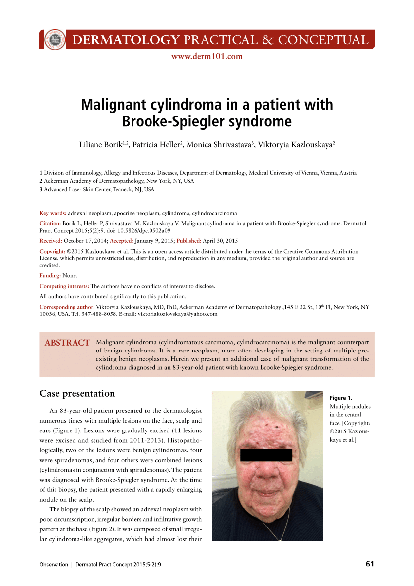 Pdf Malignant Cylindroma In A Patient With Brooke Spiegler Syndrome