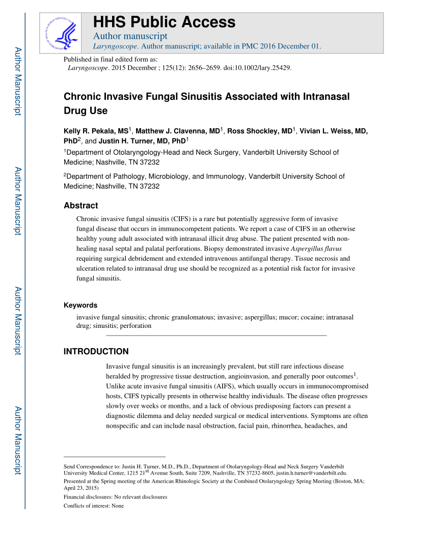 Sinus Headache or Atypical Migraine? - Weiss ENT