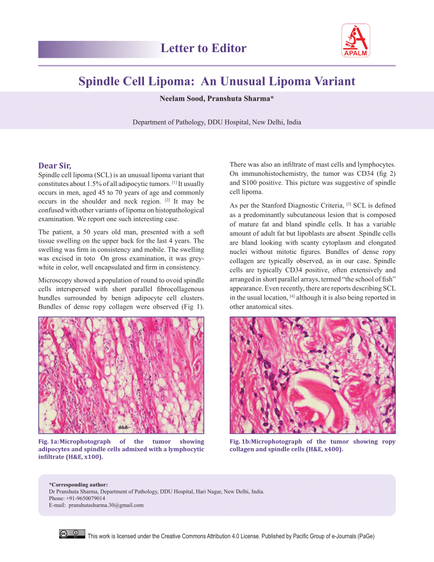 spindle cell lipoma