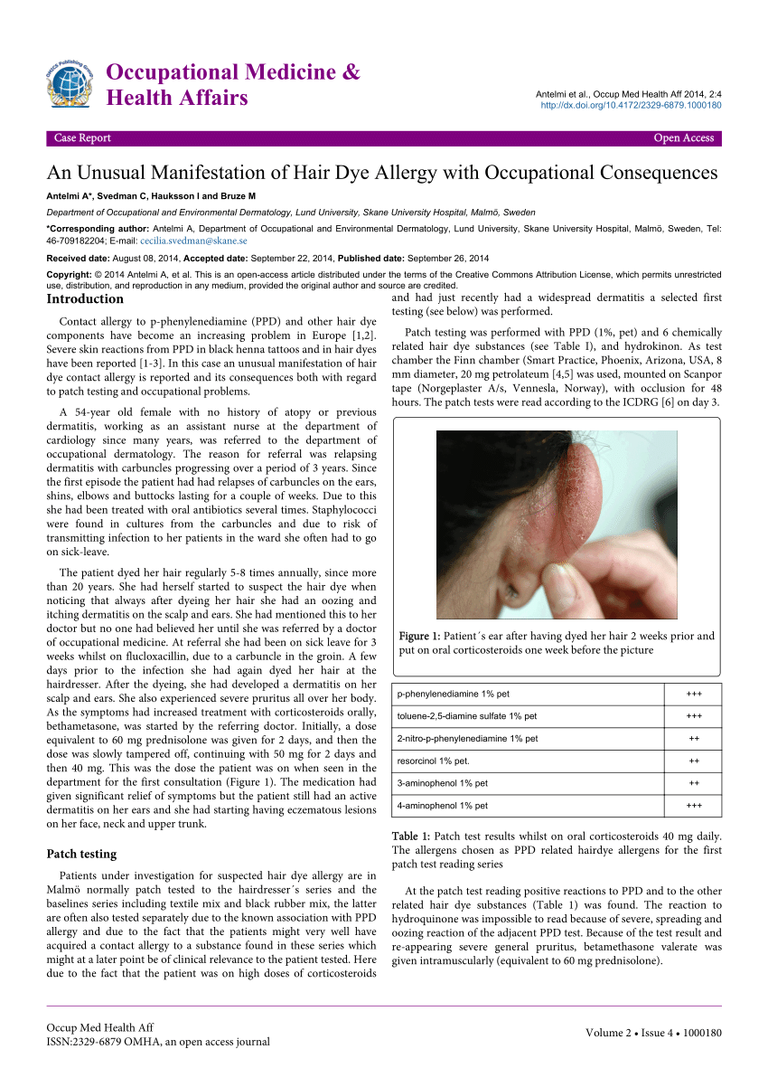 PDF) An Unusual Manifestation of Hair Dye Allergy with Occupational  Consequences