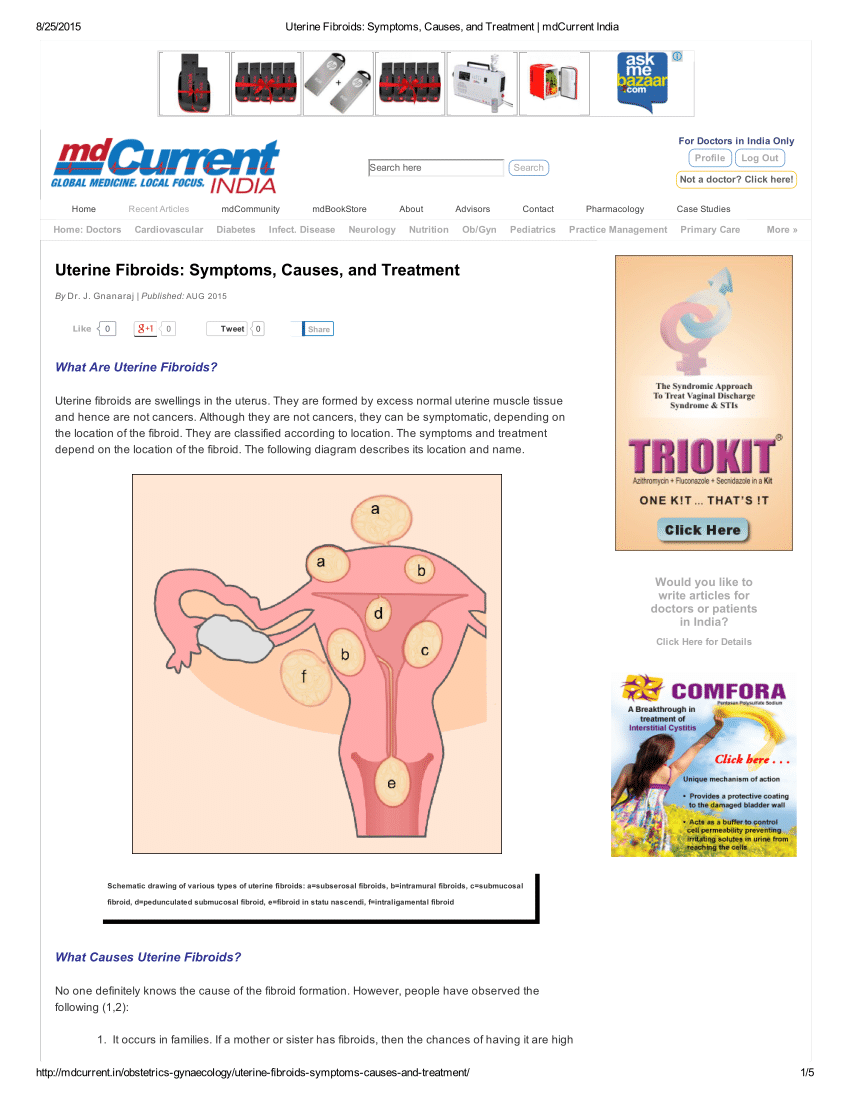 Uterine Fibroids: Symptoms, Diagnosis and Treatment 