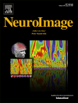 (PDF) NeuroImage Cover Image Vol 117, August 2015