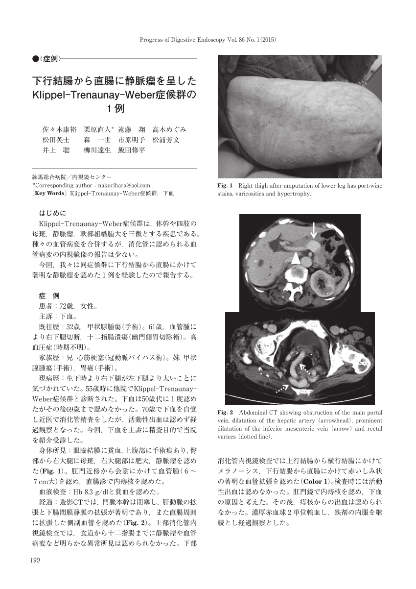 Pdf A Case Of Klippel Trenaunay Weber Syndrome With Severe Varices From The Descending Colon To The Rectum