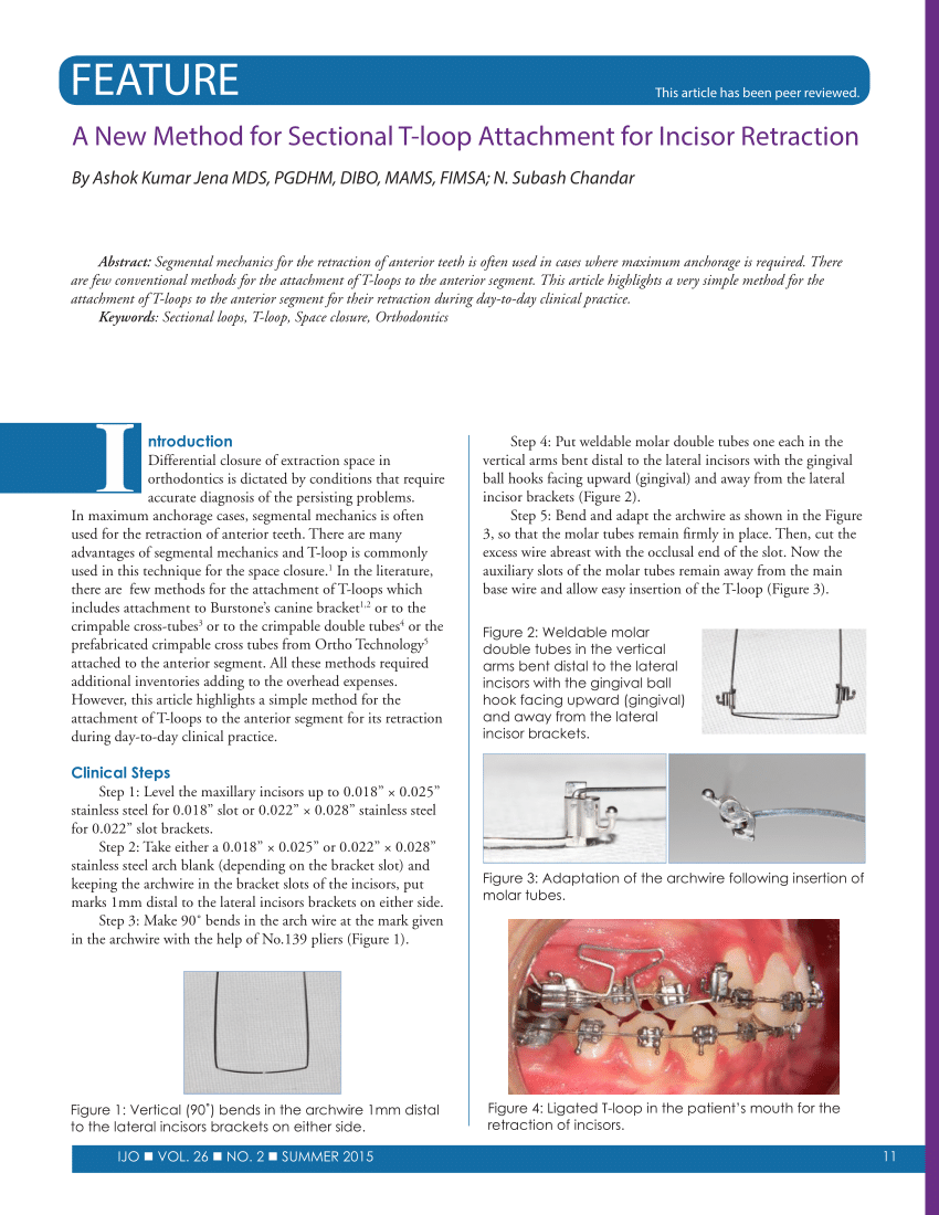 PDF) Clinical application of group B T-loop spring for retraction