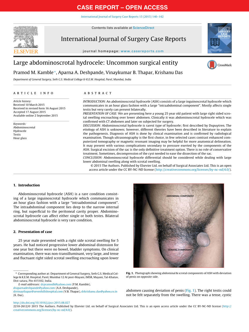 Traditie wazig Vertrouwen op Photograph showing abdominal & scrotal components of ASH with deviation...  | Download Scientific Diagram