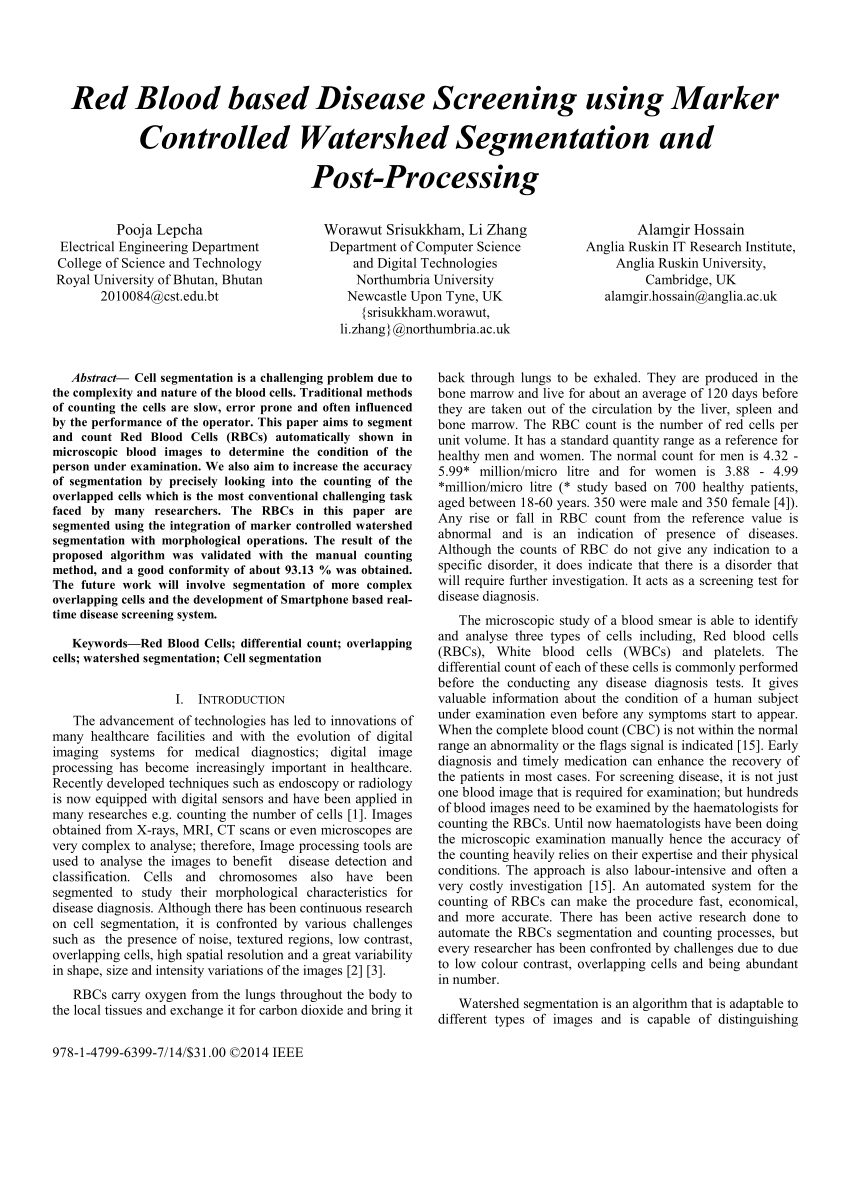 Automatic Image Segmentation of Breast Thermograms