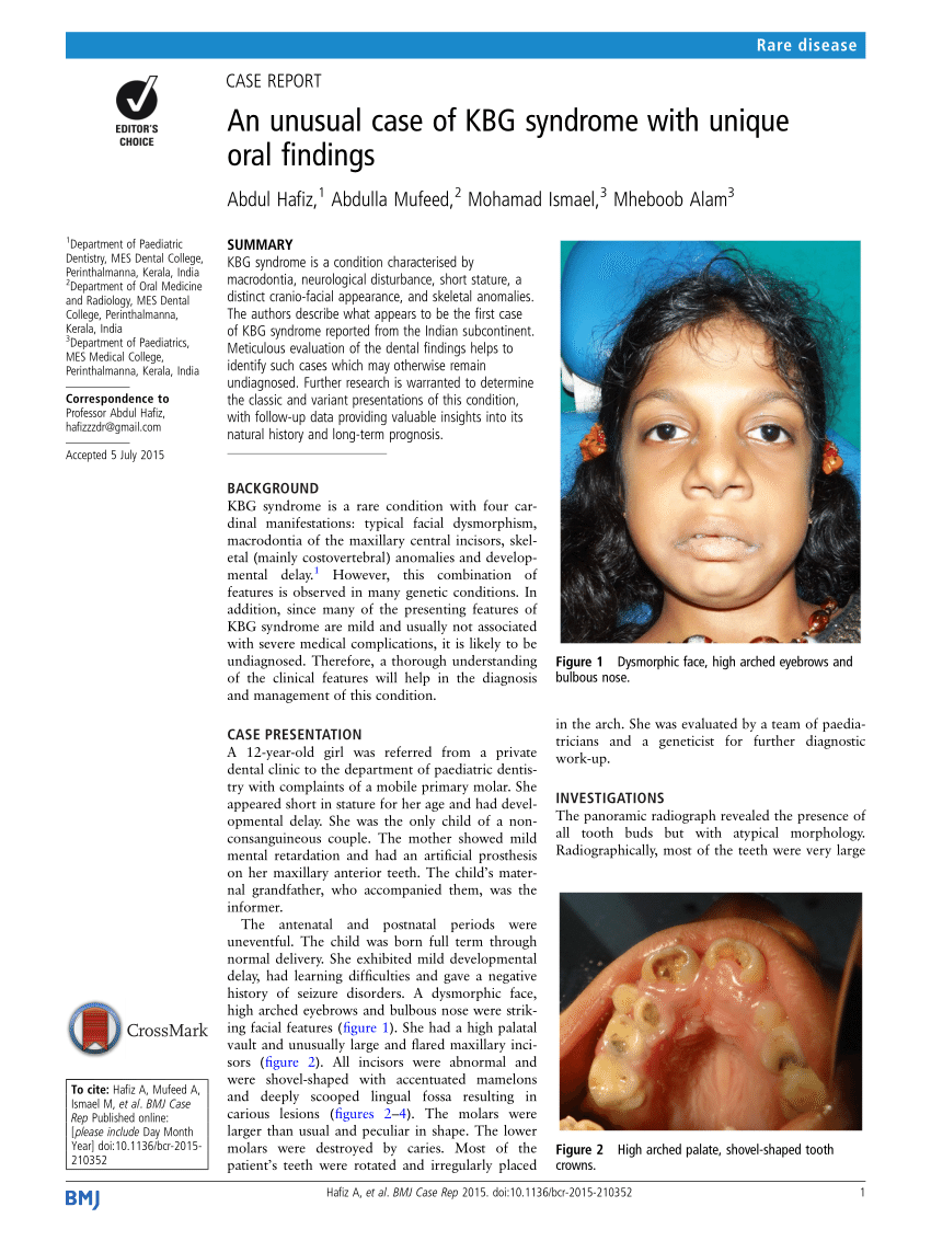 Pdf An Unusual Case Of Kbg Syndrome With Unique Oral Findings 