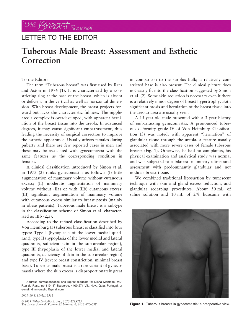 PDF) Tuberous Male Breast: Assessment and Esthetic Correction