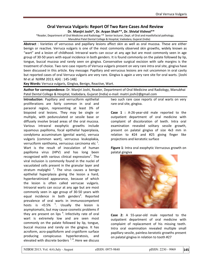 squamous papilloma vs verruca vulgaris