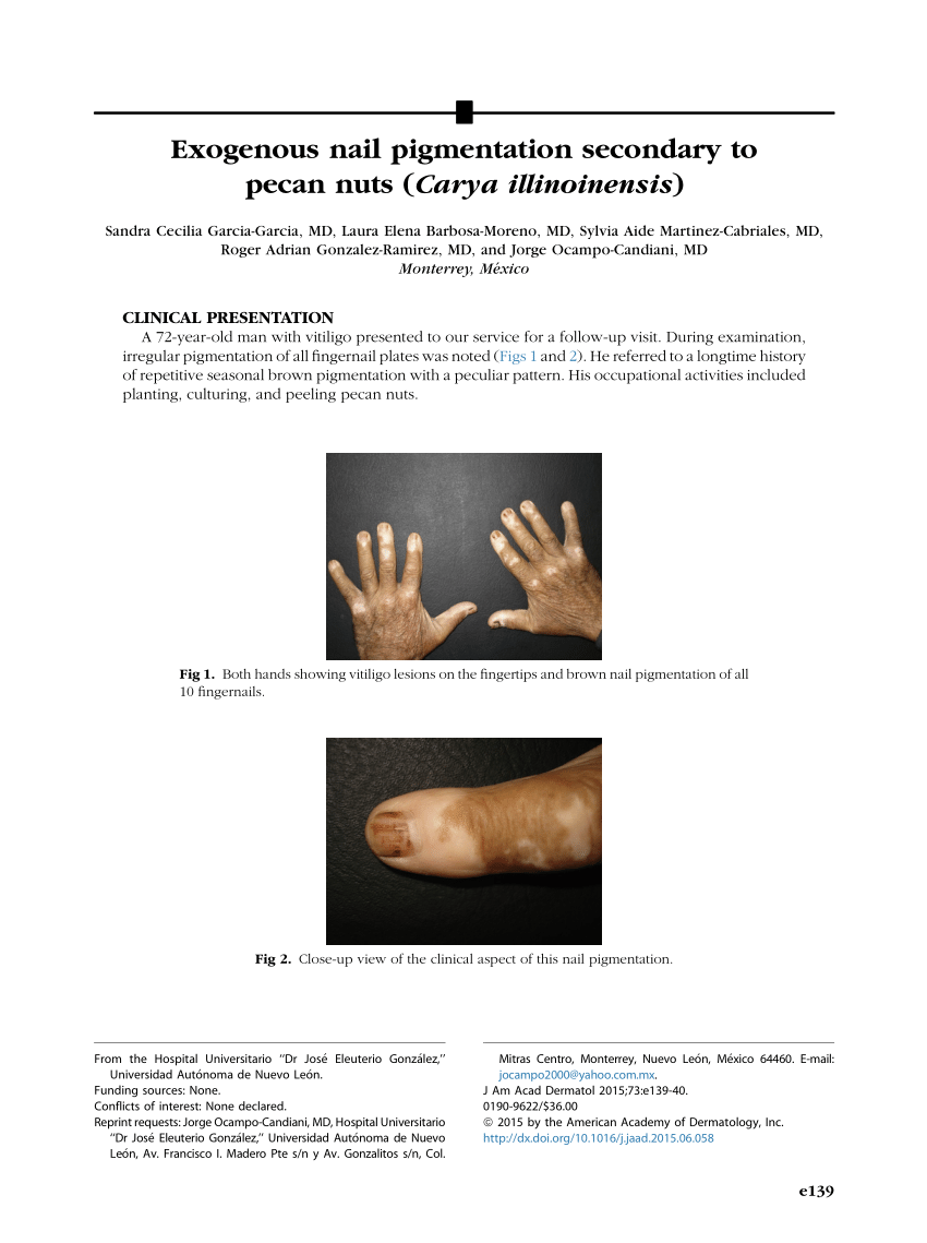 Derm Dx: Hyperpigmentation on fingers, fingernails, and lips - Clinical  Advisor