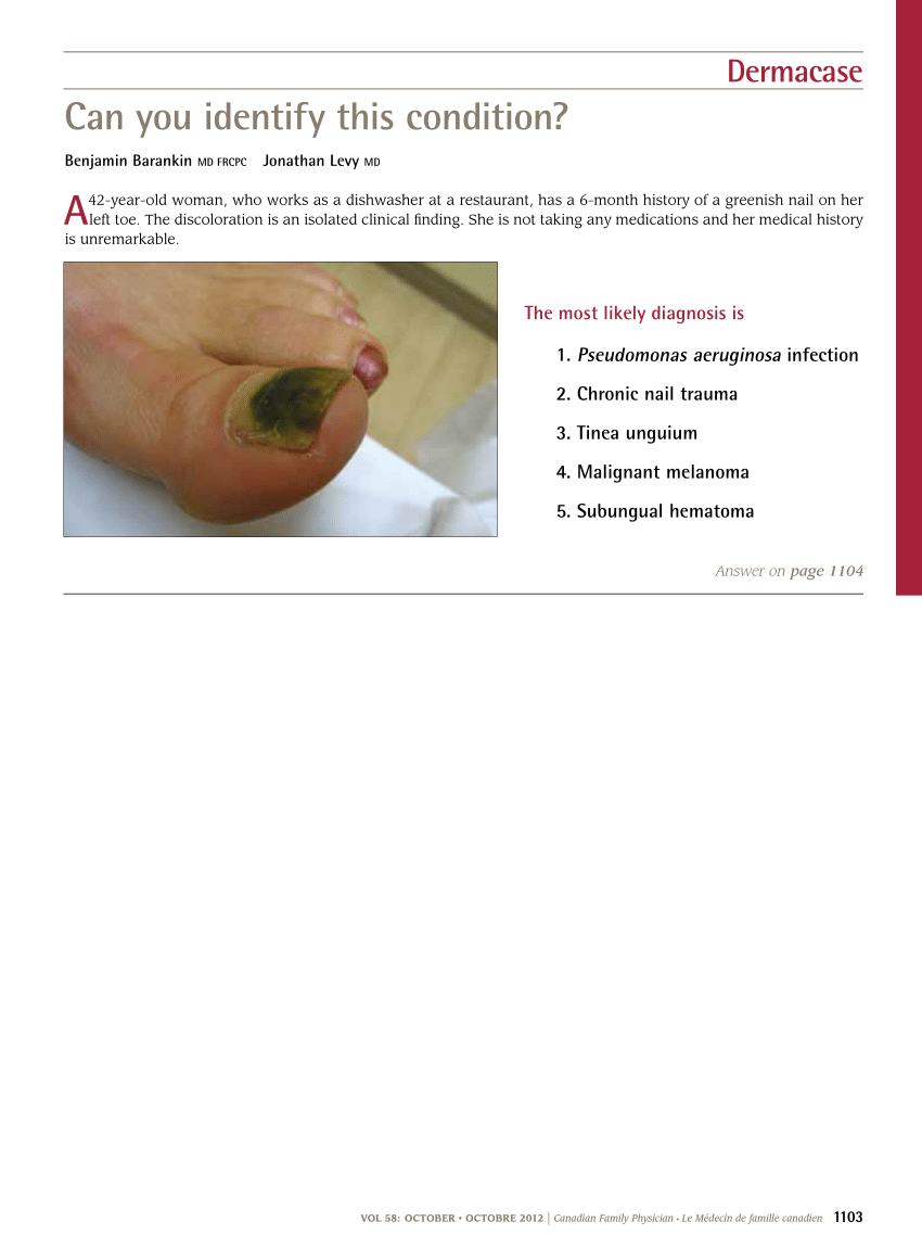 Green nail syndrome (GNS)... - ADORN NAIL Technician Course | Facebook