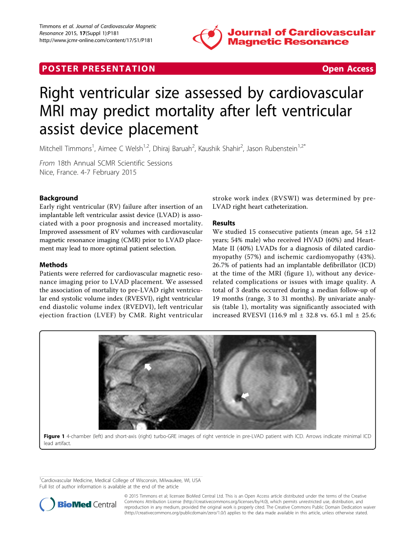 Pdf Right Ventricular Size Assessed By Cardiovascular Mri May Predict