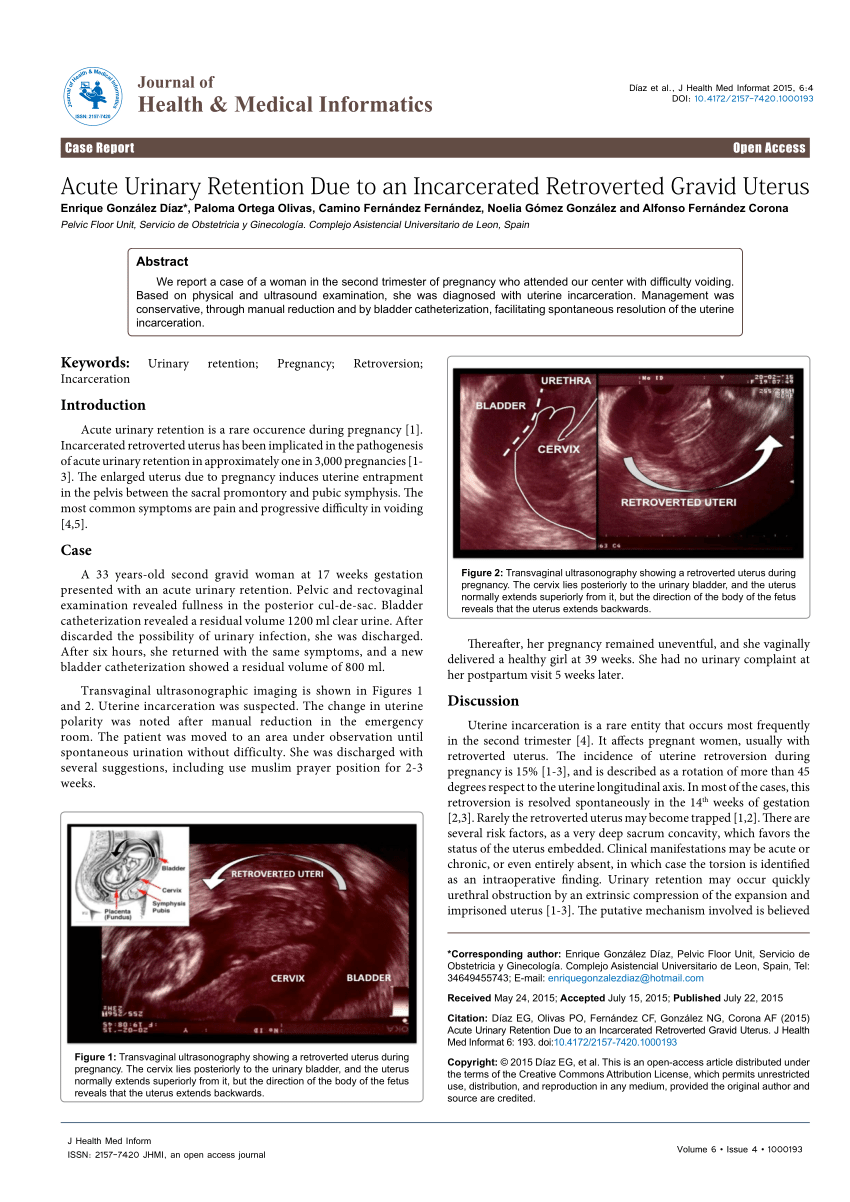 PDF) Acute Urinary Retention Due to an Incarcerated Retroverted Gravid  Uterus