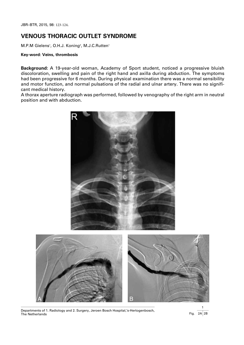 Thoracic Outlet Syndrome: Review of Surgical Approaches and Radiographic  Complications • APPLIED RADIOLOGY