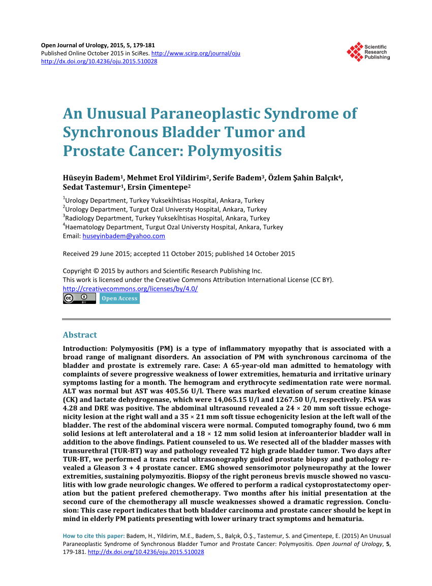 Pdf An Unusual Paraneoplastic Syndrome Of Synchronous Bladder Tumor And Prostate Cancer 2446