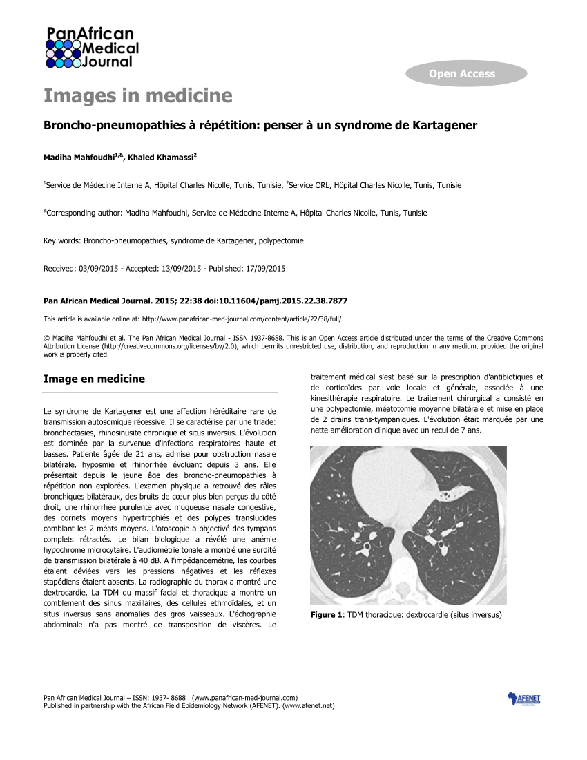 Mittens Museum rupture PDF) Broncho-pneumopathies à répétition: penser à un syndrome de Kartagener