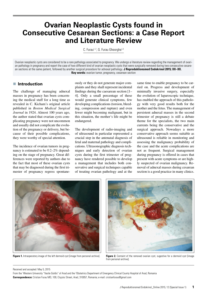 PDF) Ovarian Neoplastic Cysts found in Consecutive Cesarean