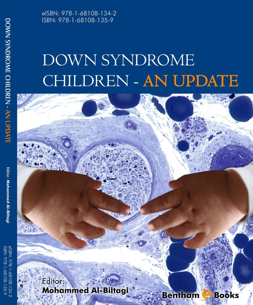 research articles on down syndrome