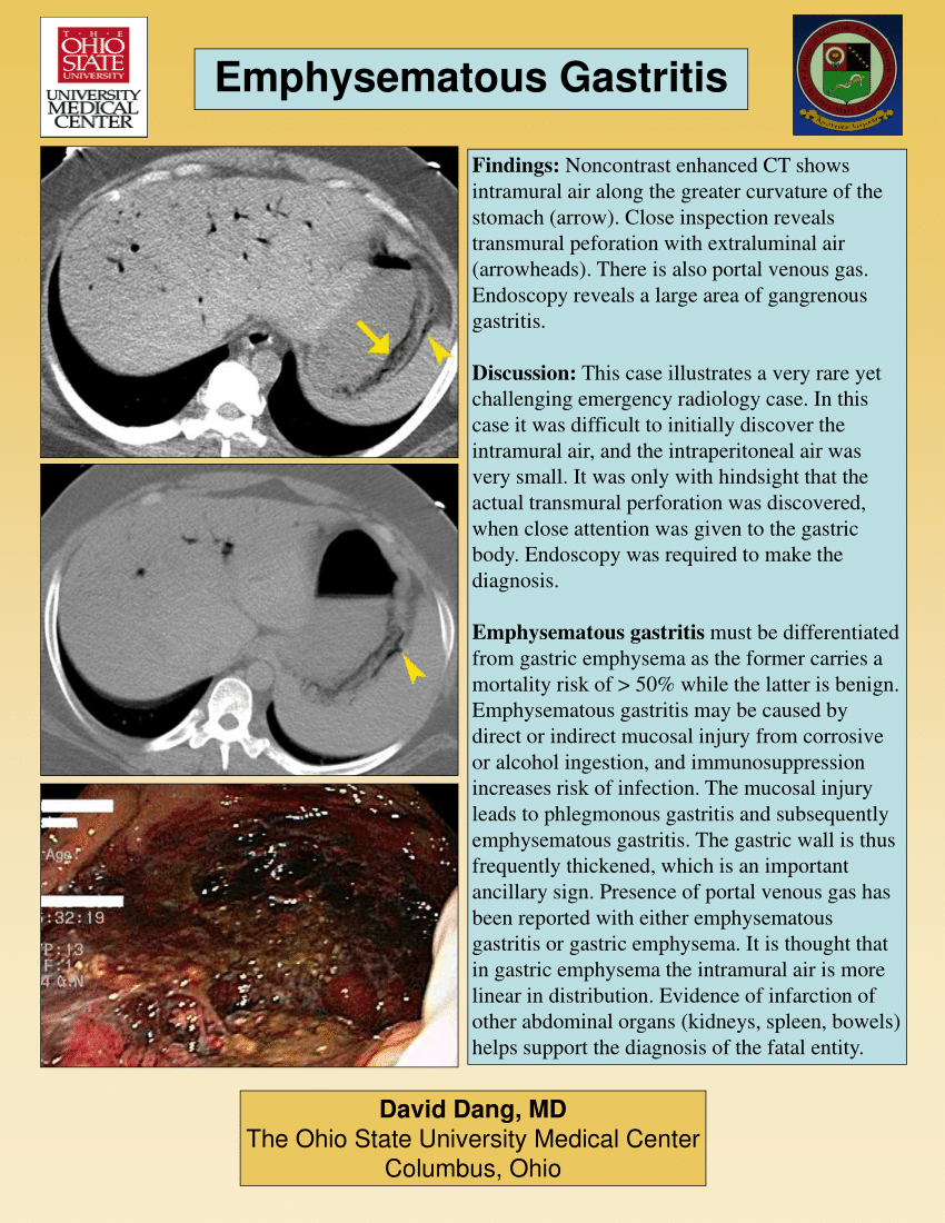 Pdf Emphysematous Gastritis