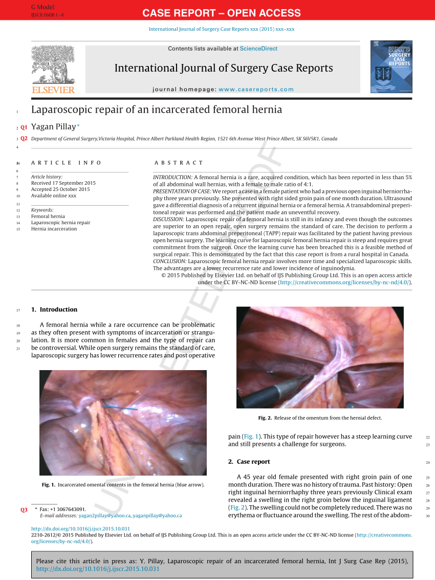 Laparoscopic repair of an incarcerated femoral hernia. - Abstract