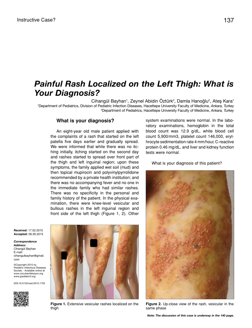 Rash On Inside Of Thigh