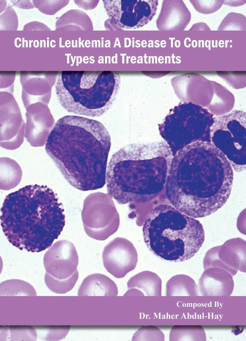 (PDF) Chronic Lymphocytic Leukemia (CLL)