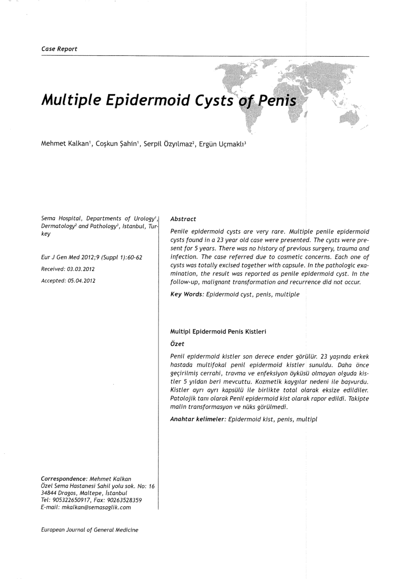 PDF Multiple Epidermoid Cysts of Penis