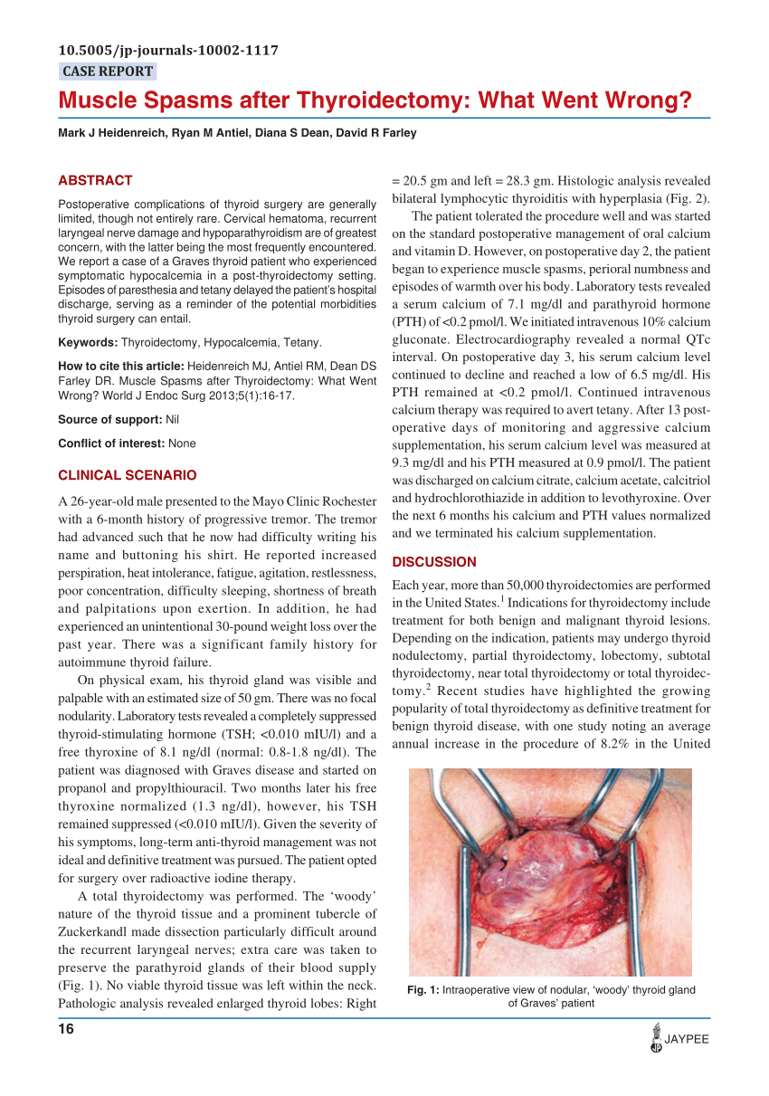 pdf-muscle-spasms-after-thyroidectomy-what-went-wrong