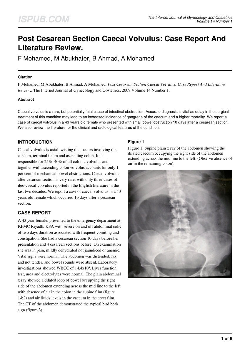 medical case report volvulus