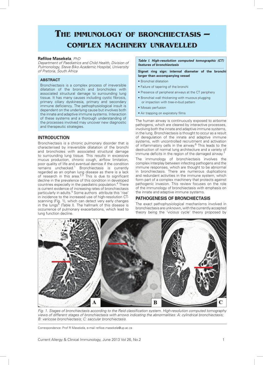 PDF The immunology of bronchiectasis Complex machinery unravelled