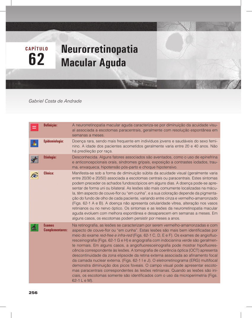 PDF) Neuroretinopatia Macular Aguda