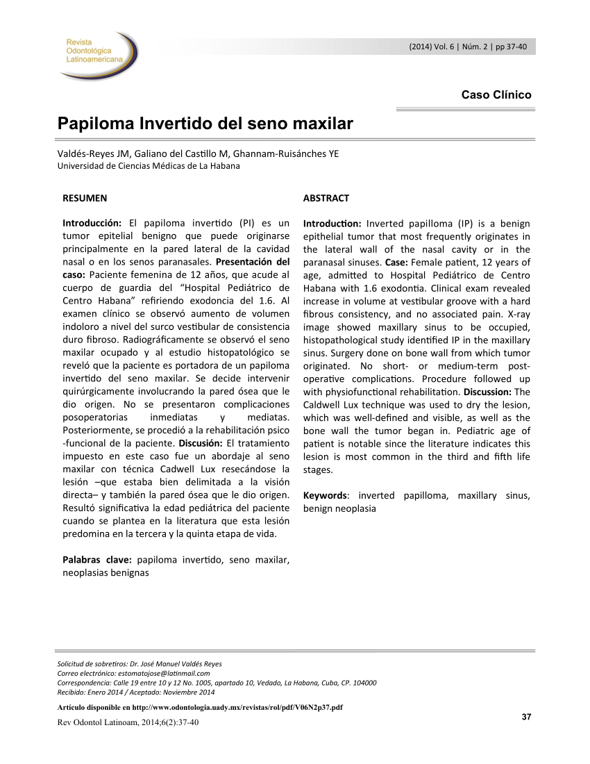 Papiloma seno maxilar, Papiloma de seno maxilar, Papiloma seno maxilar