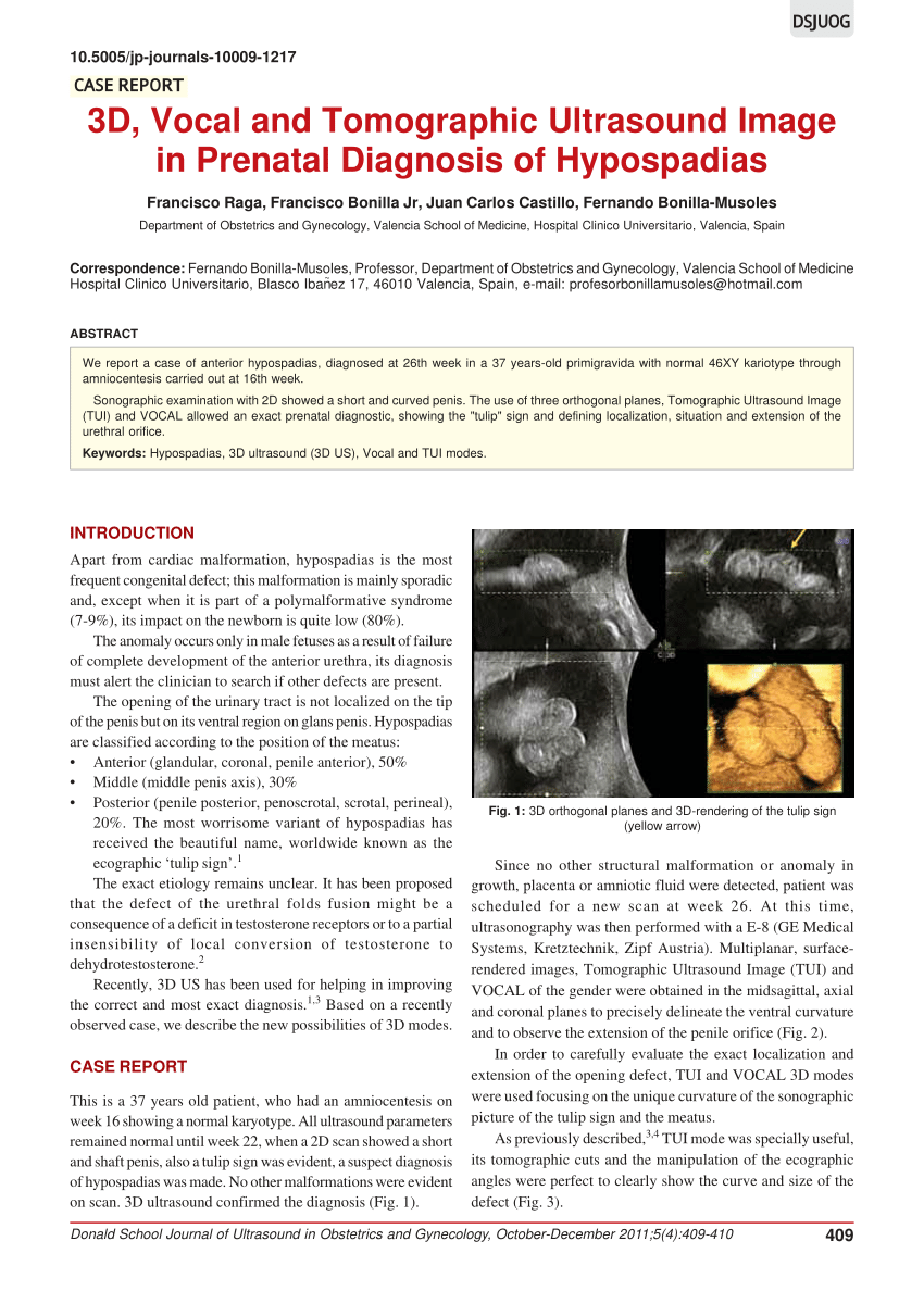 PDF 3D Vocal and Tomographic Ultrasound Image in Prenatal