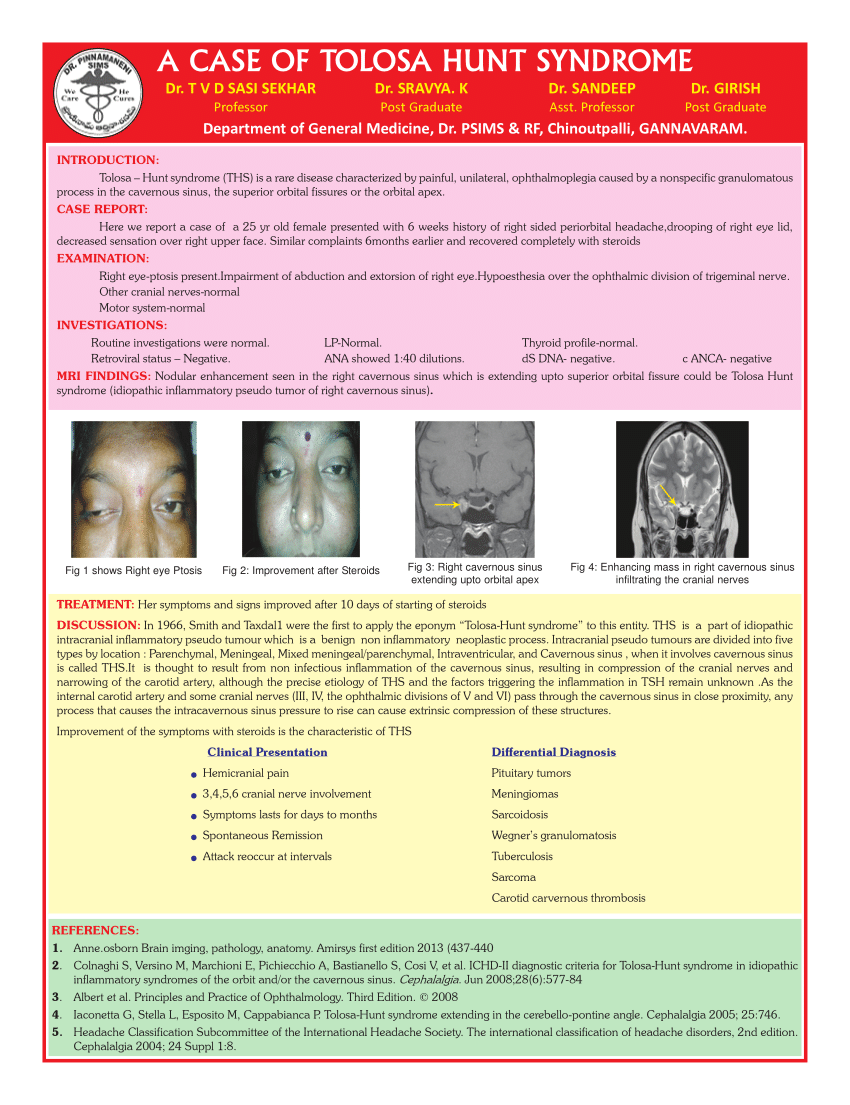 (PDF) A CASE OF TOLOSA HUNT SYNDROME