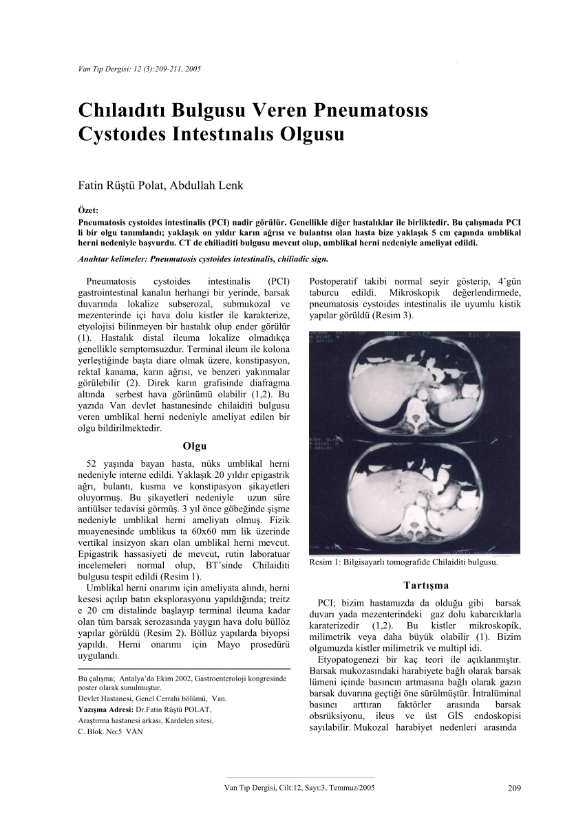 PDF Pnömatozis cystoides intestinalis A case report 