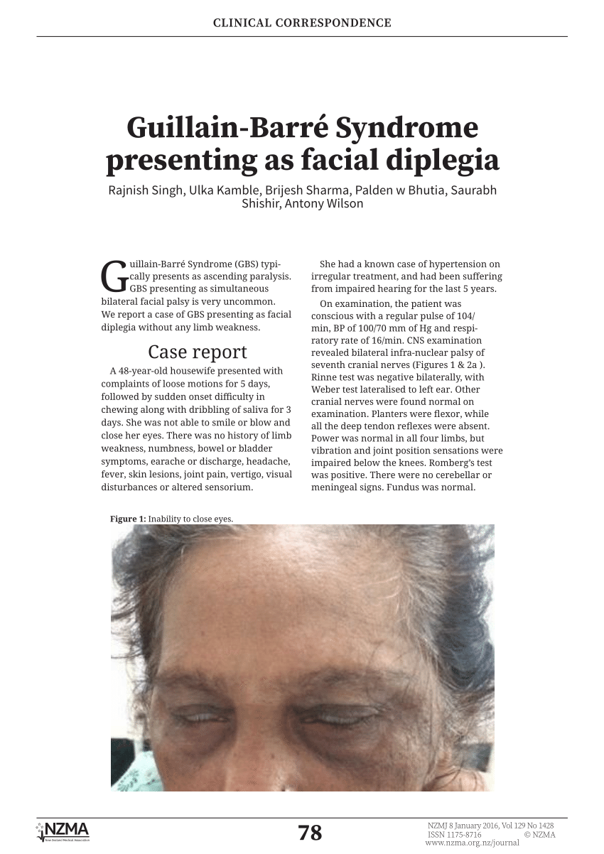 Pdf Guillain Barre Syndrome Presenting As Facial Diplegia