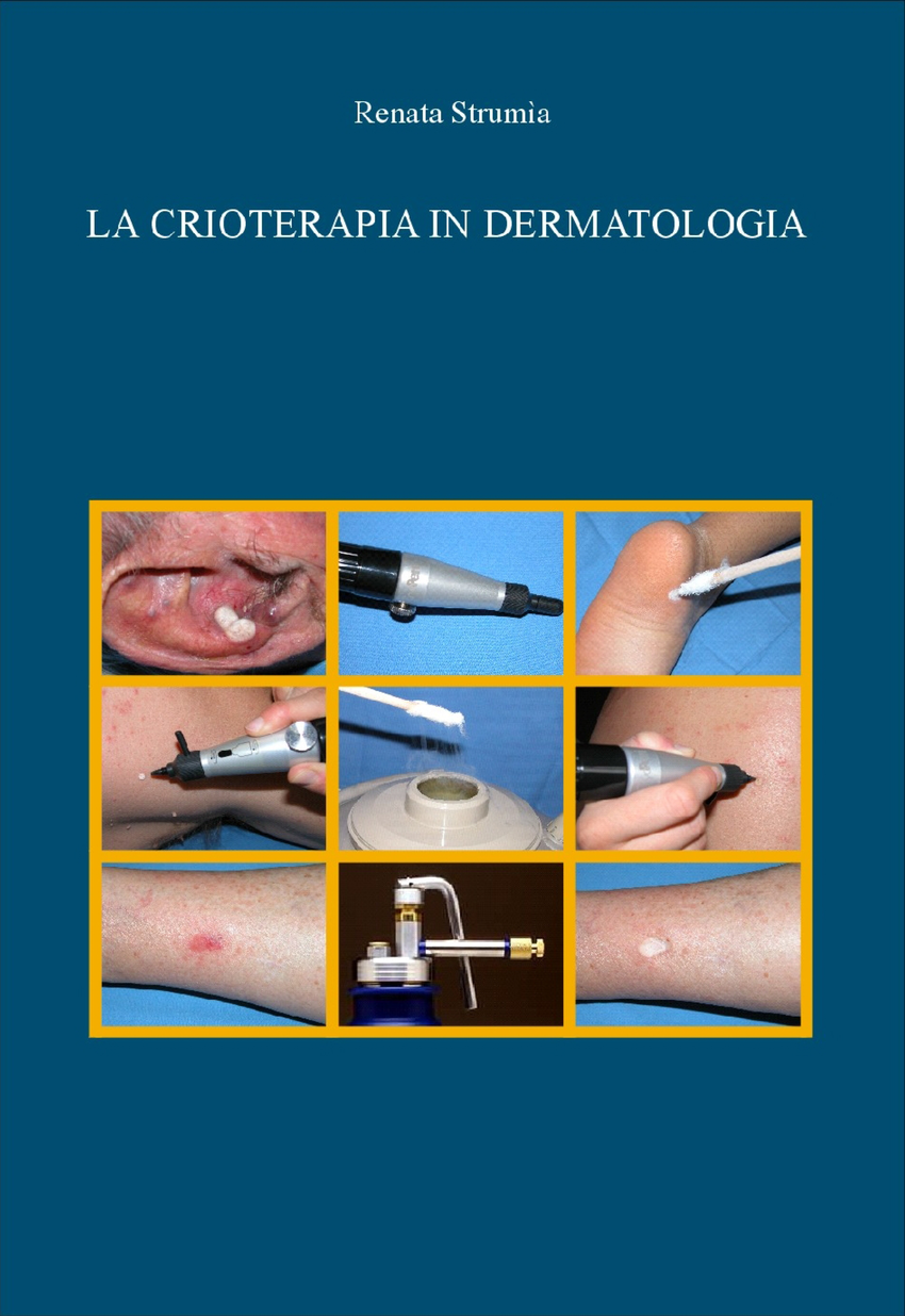Unidad de Crioterapia. Dermato, Ginecología, Urología ❤️