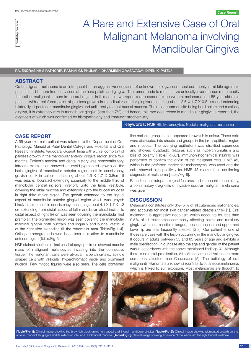 Pdf A Rare And Extensive Case Of Oral Malignant Melanoma Involving Mandibular Gingiva 