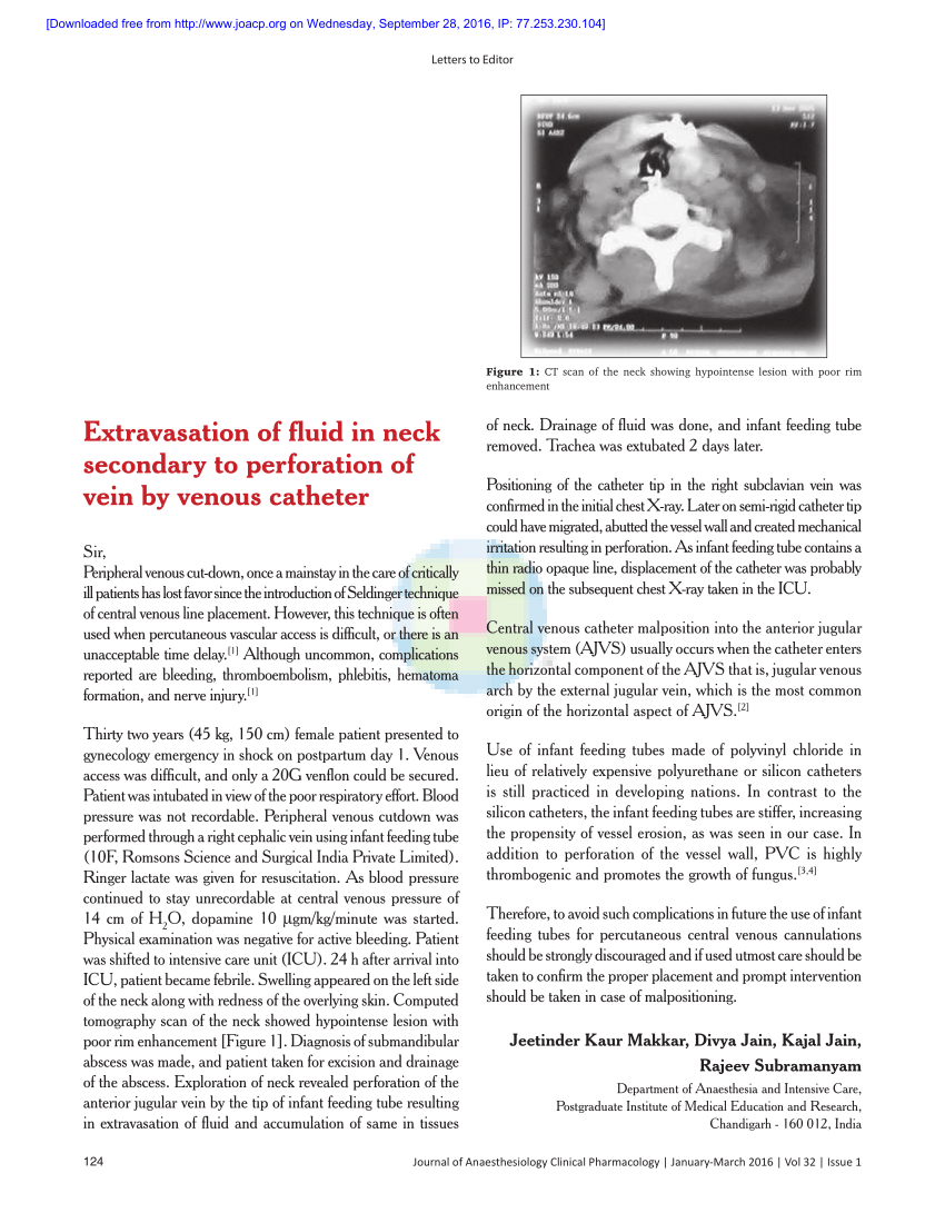 Pdf Extravasation Of Fluid In Neck Secondary To Perforation