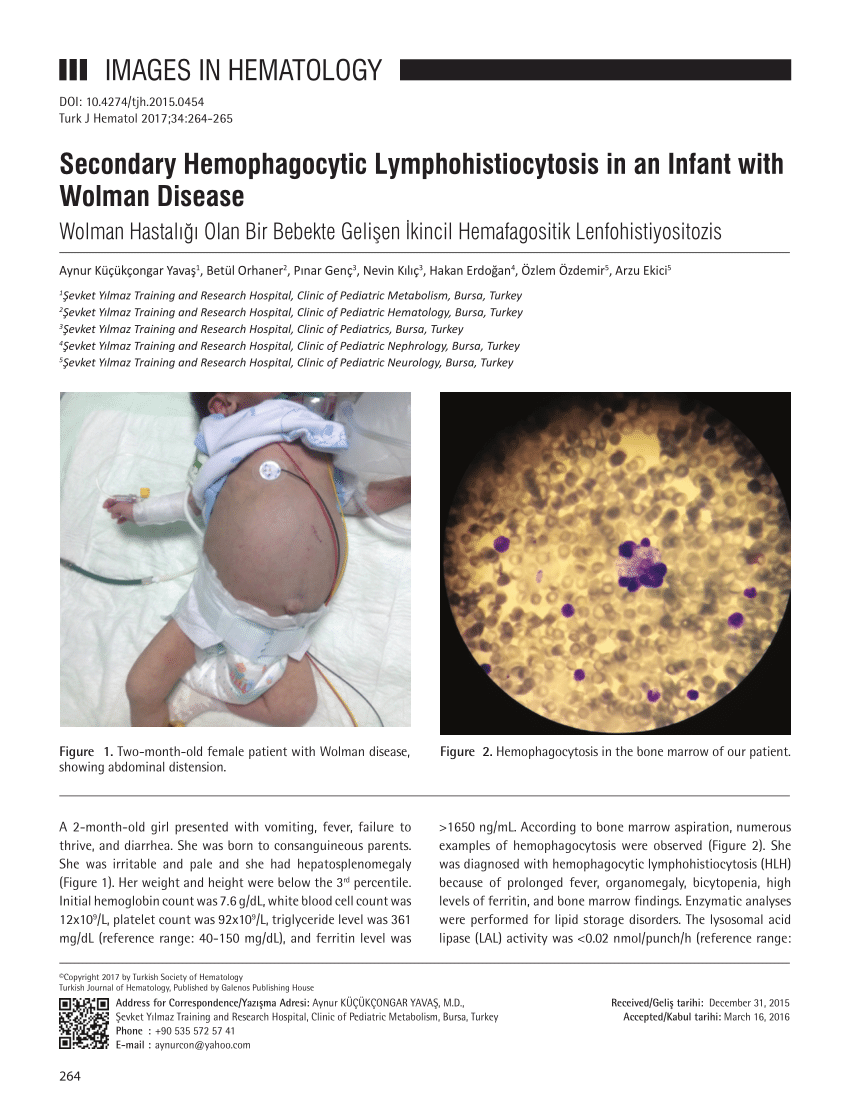 (PDF) Secondary hemophagocytic lymphohistiocytosis in an infant with