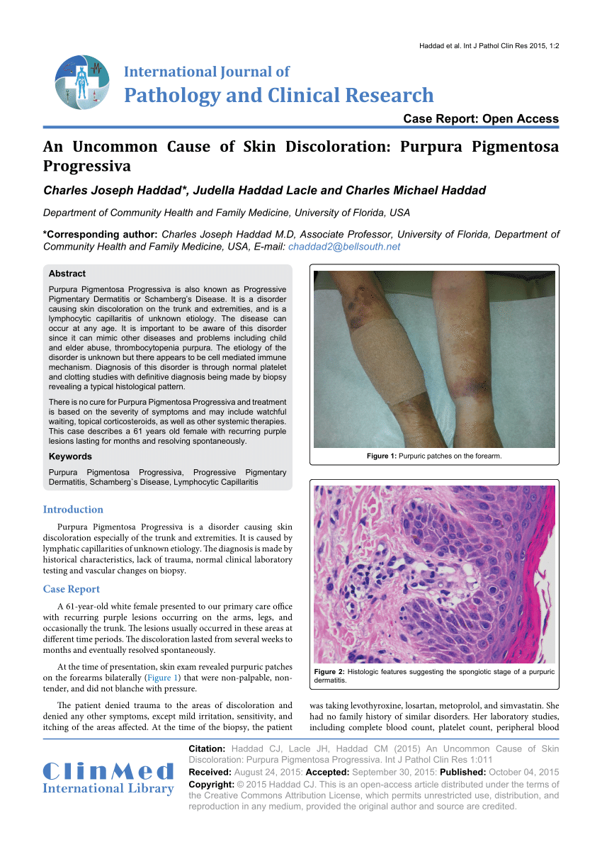 (PDF) An Uncommon Cause of Skin Discoloration: Purpura ...