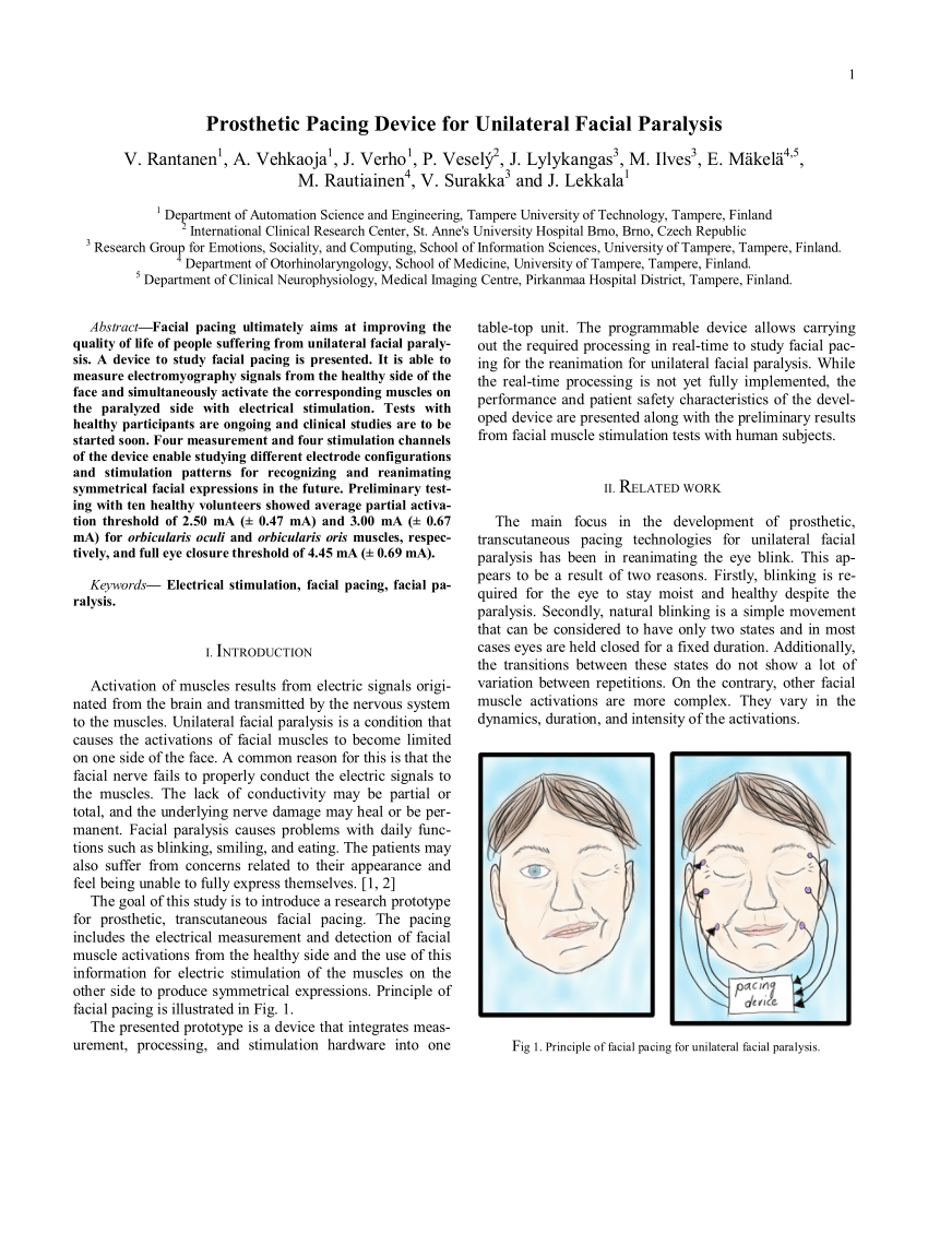 https://i1.rgstatic.net/publication/299597842_Prosthetic_Pacing_Device_for_Unilateral_Facial_Paralysis/links/59f98783458515547c26c5c2/largepreview.png