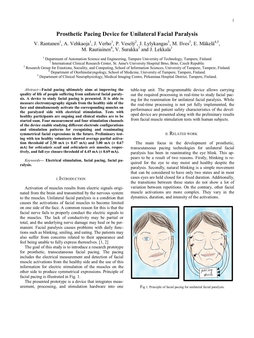 IFT + FACIAL Stimulator for Bell's Palsy - Techno Health