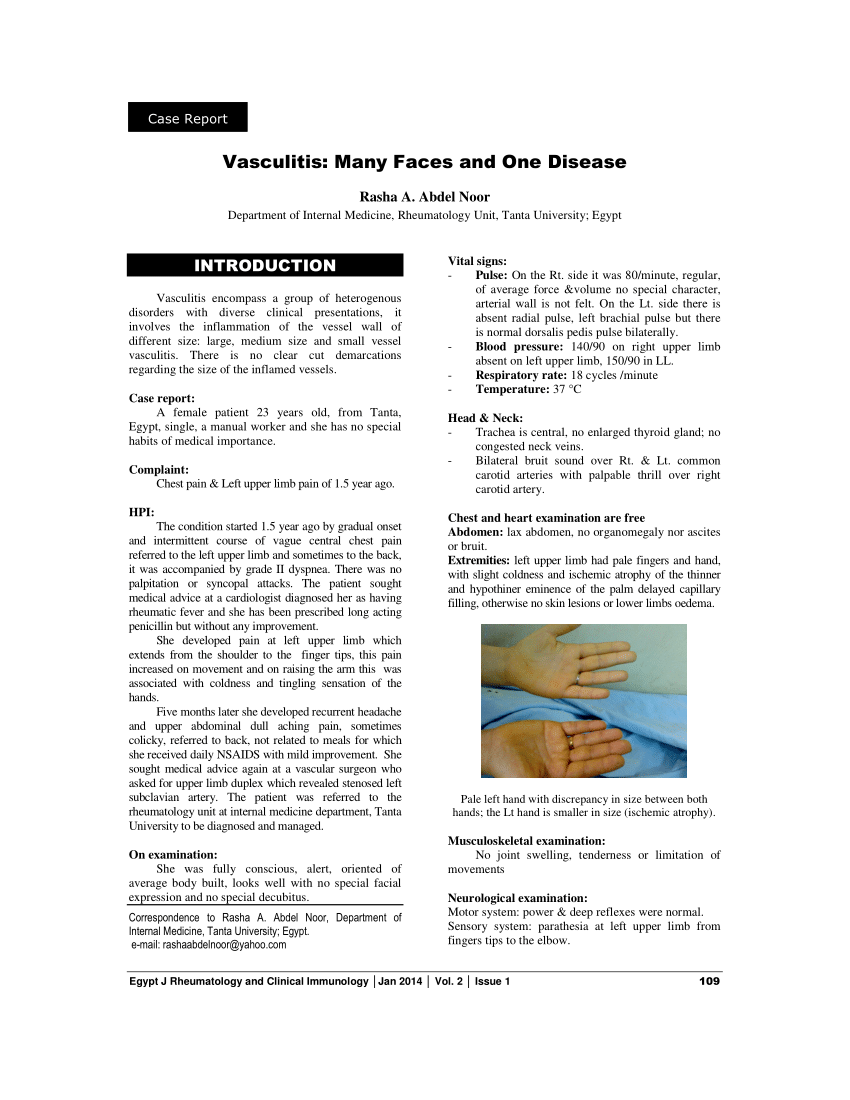 vasculitis case study report