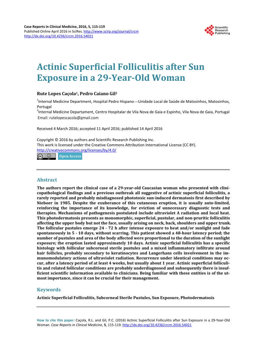 Pdf Actinic Superficial Folliculitis After Sun Exposure In A 29 Year Old Woman