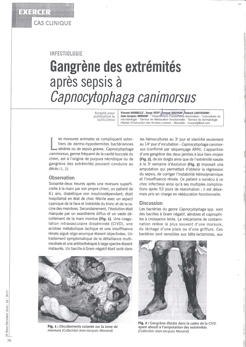 Pdf Gangrene Des Extremites Apres Sepsis A Capnocytophaga Canimorsus