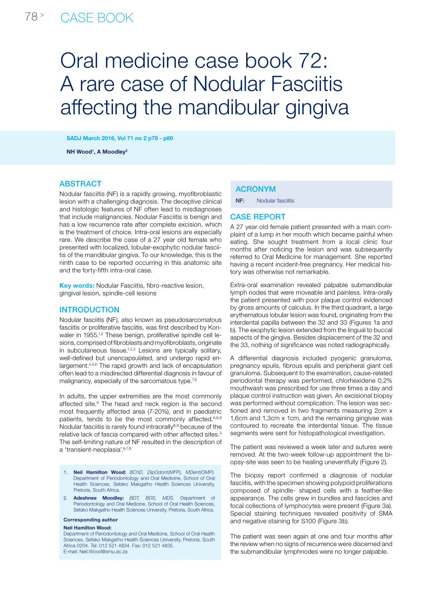 Pdf A Rare Case Of Nodular Fasciitis Affecting The Mandibular Gingia