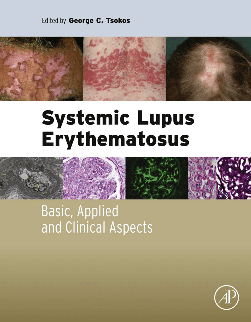 lupus novel pdf