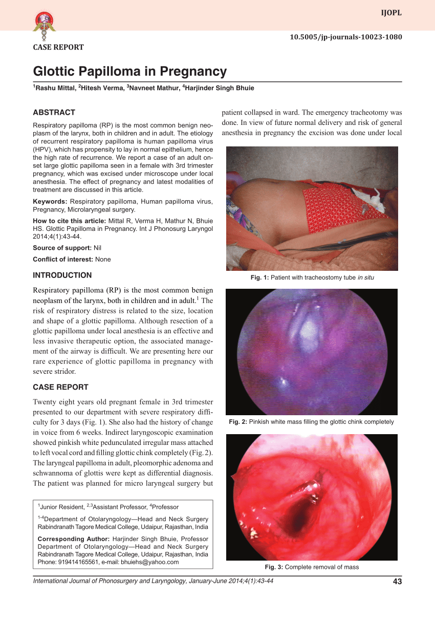 laryngeal papillomatosis pregnancy